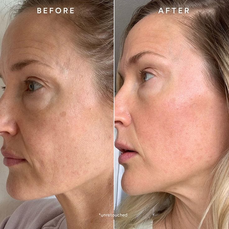 original-deep-collagen-mask-4-week-glow-challenge-227515